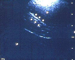 transthoracic echocardiogram sle report japanese circulation society transthoracic echocardiogram sle report japanese circulation society