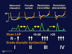 What is the treatment and prognosis for diastolic dysfunction?