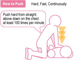 How to perform chest compressions